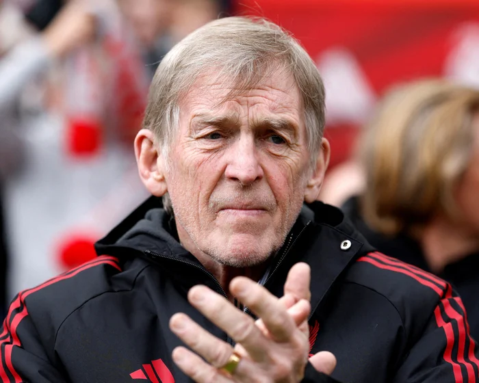 Kenny Dalglish Shares Cancer Diagnosis, Treatment Progress